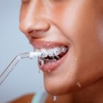 oral hygiene with braces, braces care, dental tips for braces, Granbury Park Dental, Dr. Paul Froude, Granbury TX dentist, orthodontic care, healthy gums with braces, flossing with braces, brushing with braces