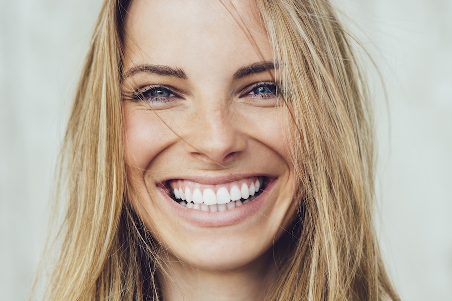 teeth whitening results and teeth whitening aftercare